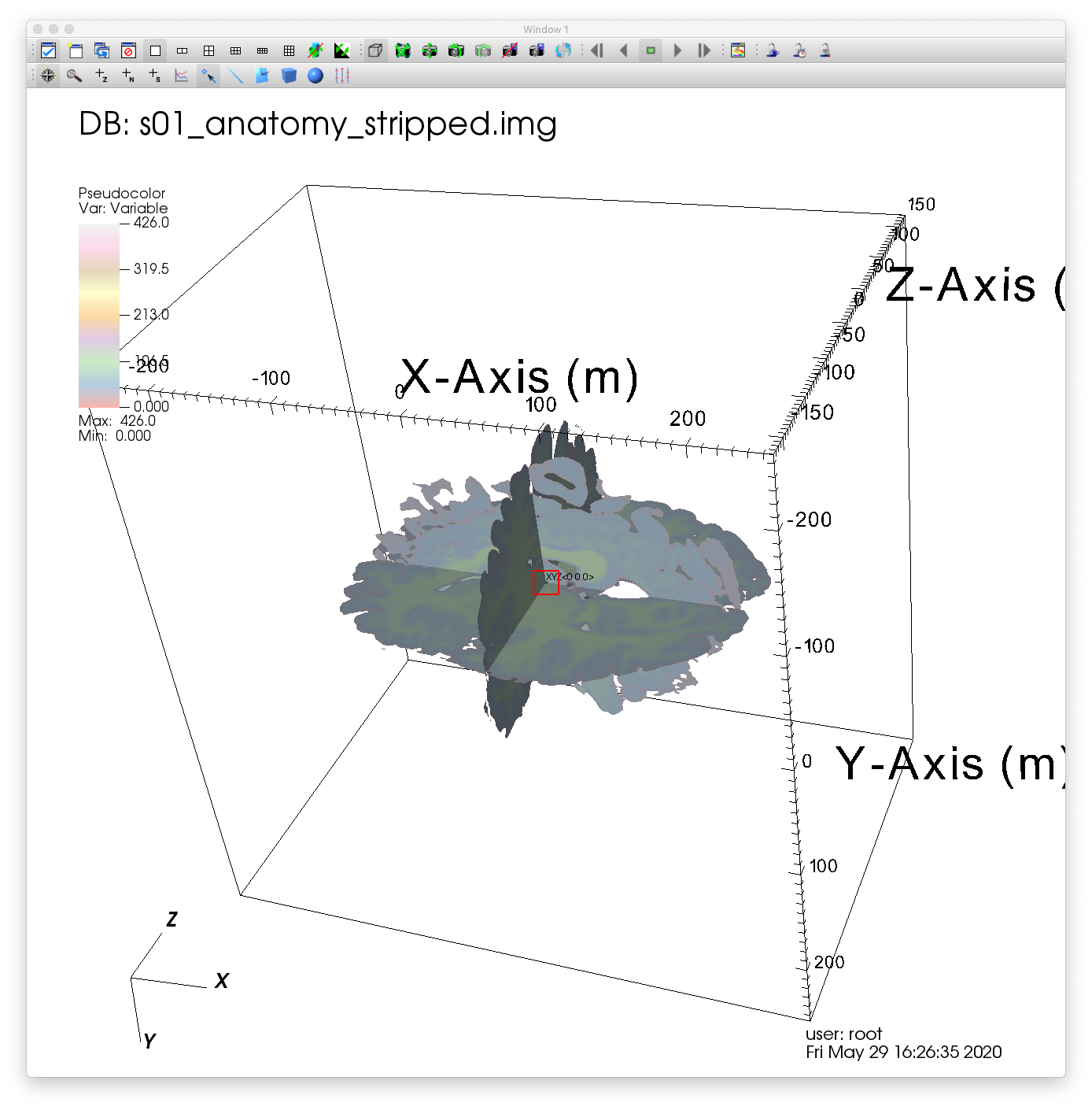 ../_images/MRI_Point_Tool.png