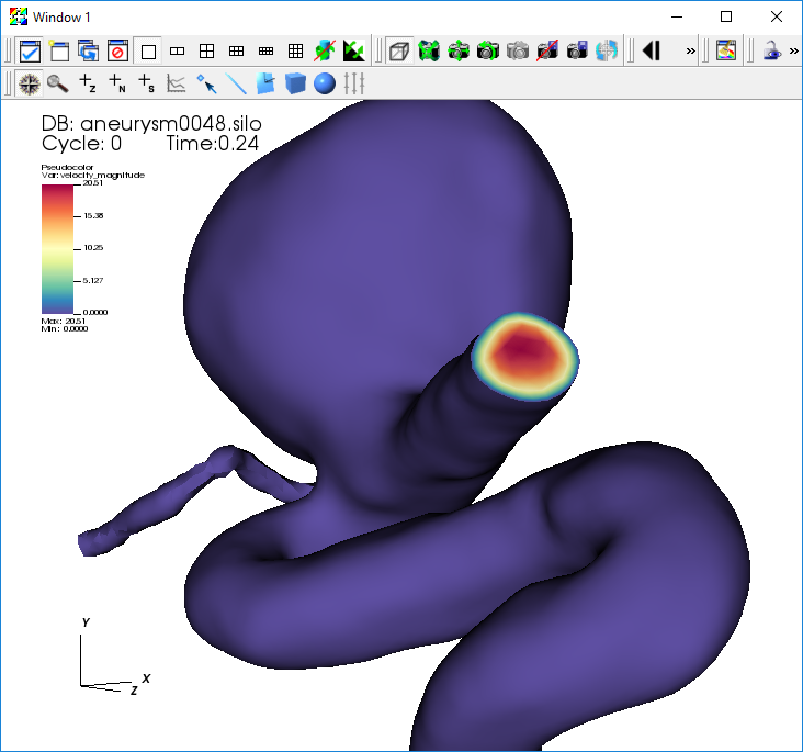 ../_images/Aneurysm-PseudocolorVelocityMagnitude.png